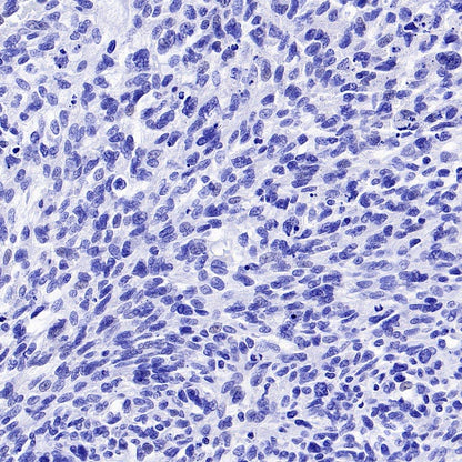 TMEM16A Recombinant Rabbit mAb (SDT-2179-68)