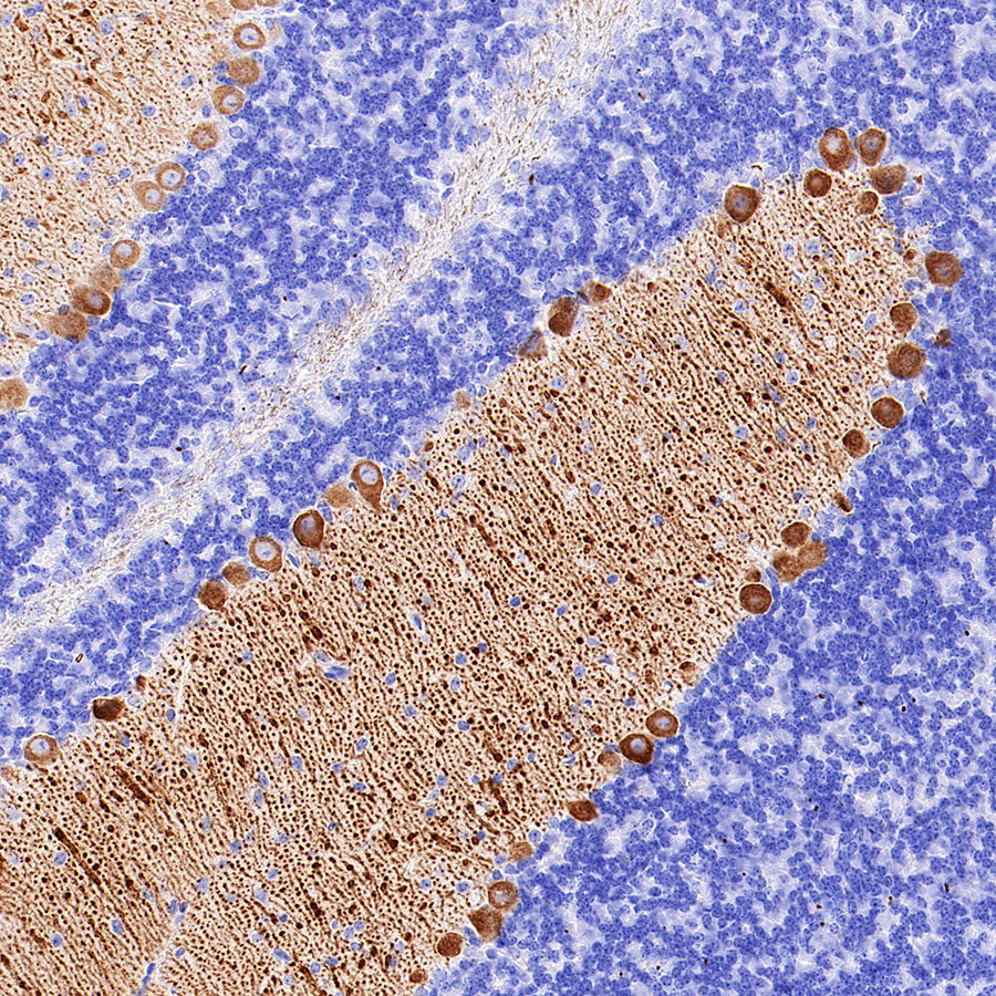 ITPR1 Recombinant Rabbit mAb (S-4530-47)