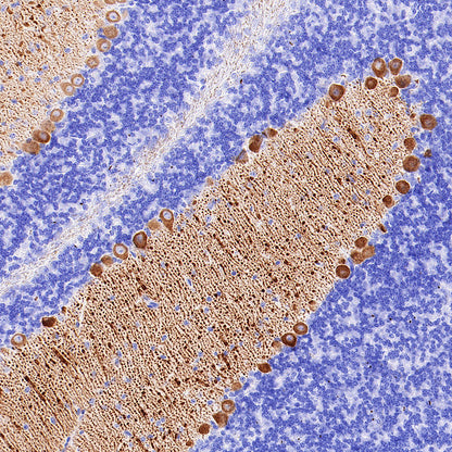 ITPR1 Recombinant Rabbit mAb (S-4530-47)