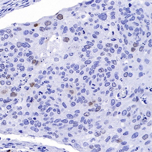 p21 Waf1/Cip1 Mouse mAb (469-2)