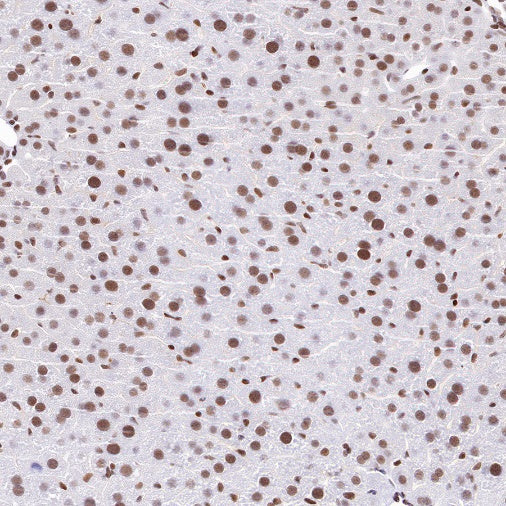 CTCF Recombinant Rabbit mAb (S-1822-42)