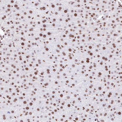 CTCF Recombinant Rabbit mAb (S-1822-42)