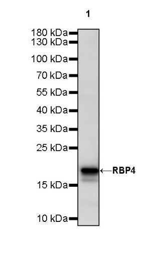 RBP4 Recombinant Rabbit mAb (S-693-111)