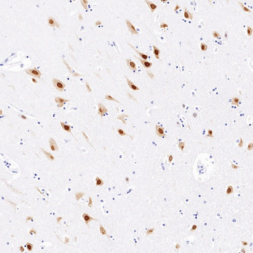 HuD/ELAVL4 Recombinant Rabbit mAb (S-1351-159)