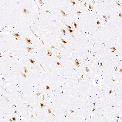 HuD/ELAVL4 Recombinant Rabbit mAb (S-1351-159)