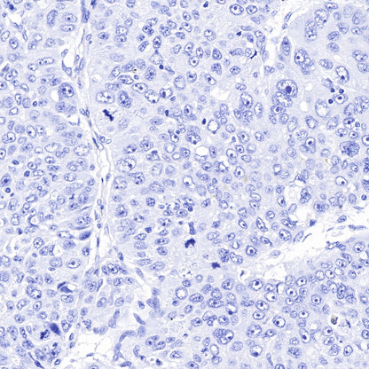 PAPP-A Recombinant Rabbit mAb (SDT-226-46)