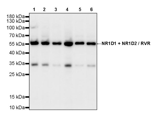 NR1D1 + NR1D2 / RVR Recombinant Rabbit mAb (S-5962)