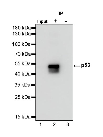 S-RMab® p53 Recombinant Rabbit mAb (SDT-R118)
