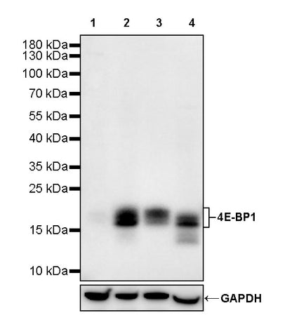 4E-BP1 Recombinant Rabbit mAb (S-4103-65)