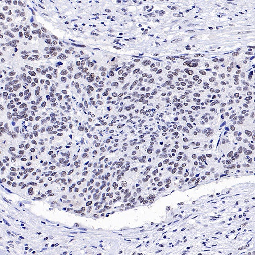RNF40 Recombinant Rabbit mAb (S-1068-279)