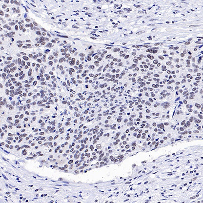 RNF40 Recombinant Rabbit mAb (S-1068-279)