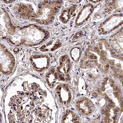 SCARB2/LIMPII Recombinant Rabbit mAb (S-2847-21)