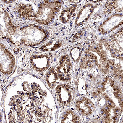 SCARB2/LIMPII Recombinant Rabbit mAb (S-2847-21)