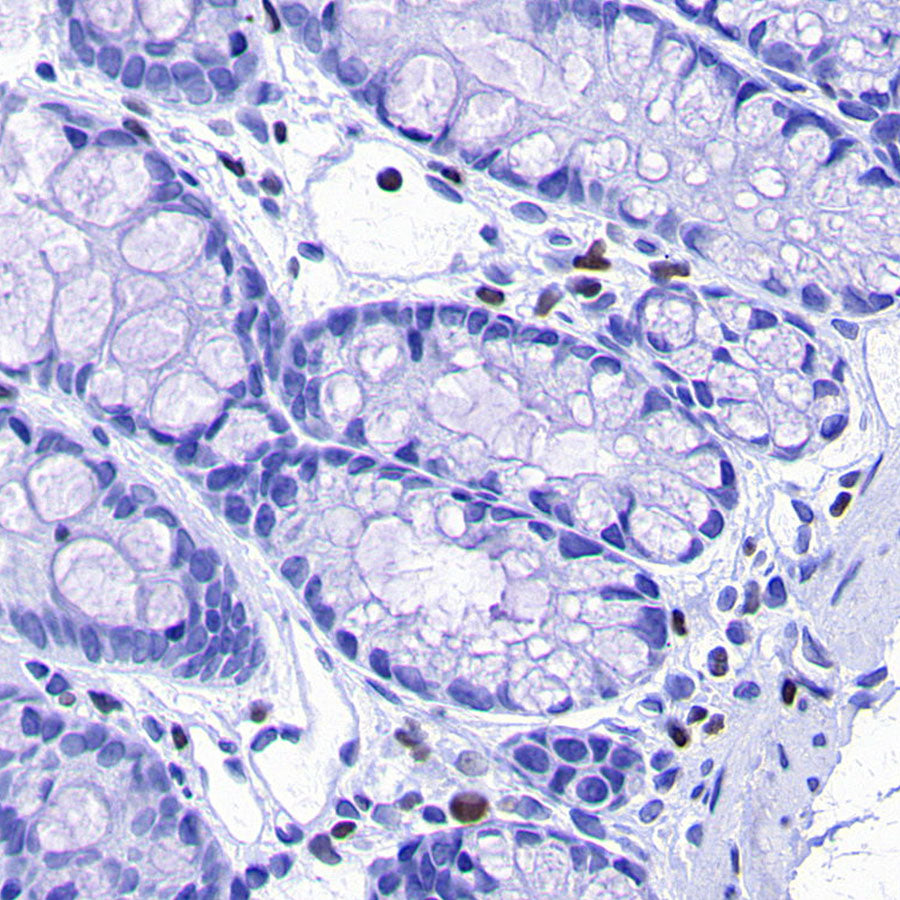 IKZF1 Recombinant Rabbit mAb (S-4176-17)