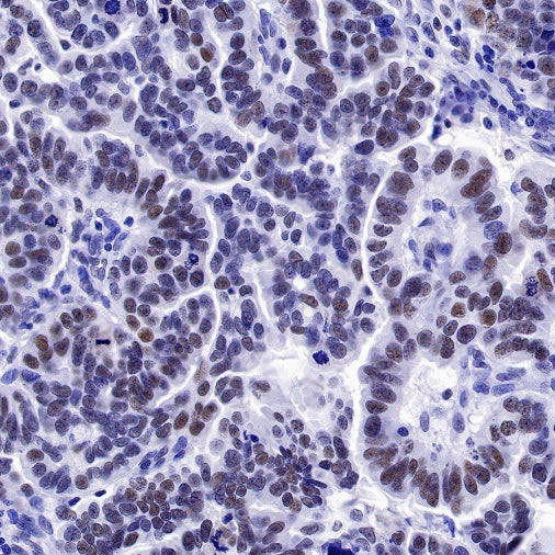 S-RMab® PMS2 Recombinant Rabbit mAb (SDT-R460)