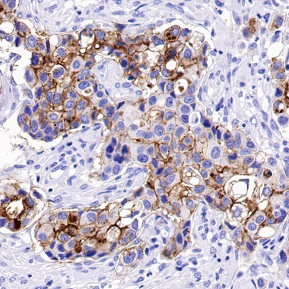 Claudin 3+Claudin 9 Recombinant Rabbit mAb (SDT-1452-69)