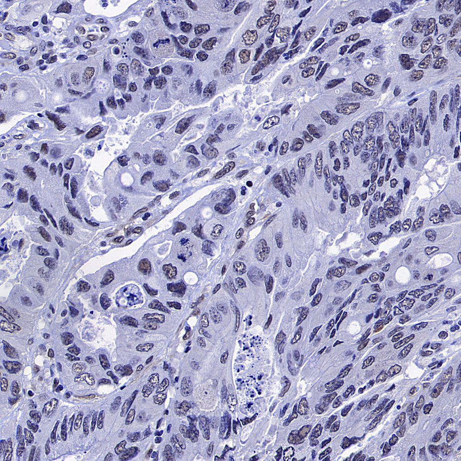 Caspase-8 Recombinant Rabbit mAb (S-2676-121)