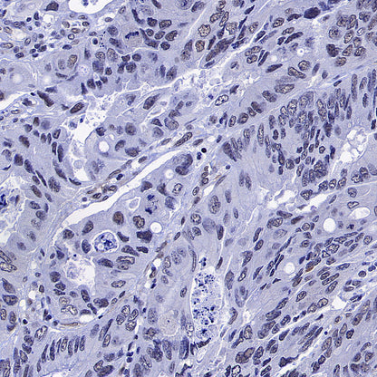 Caspase-8 Recombinant Rabbit mAb (S-2676-121)