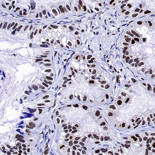 HAT1 Recombinant Rabbit mAb (S-2429-14)