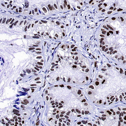 HAT1 Recombinant Rabbit mAb (S-2429-14)