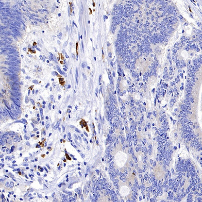 CXCR3 Recombinant Rabbit mAb (S-377-8)