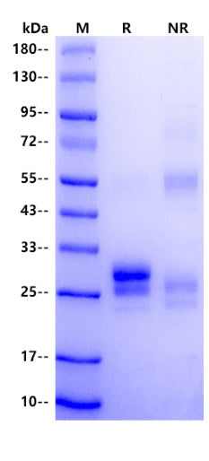 TNFSF15 His Tag Protein, Rhesus macaque