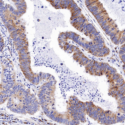 Ndufs4 Recombinant Rabbit mAb (S-1459-14)