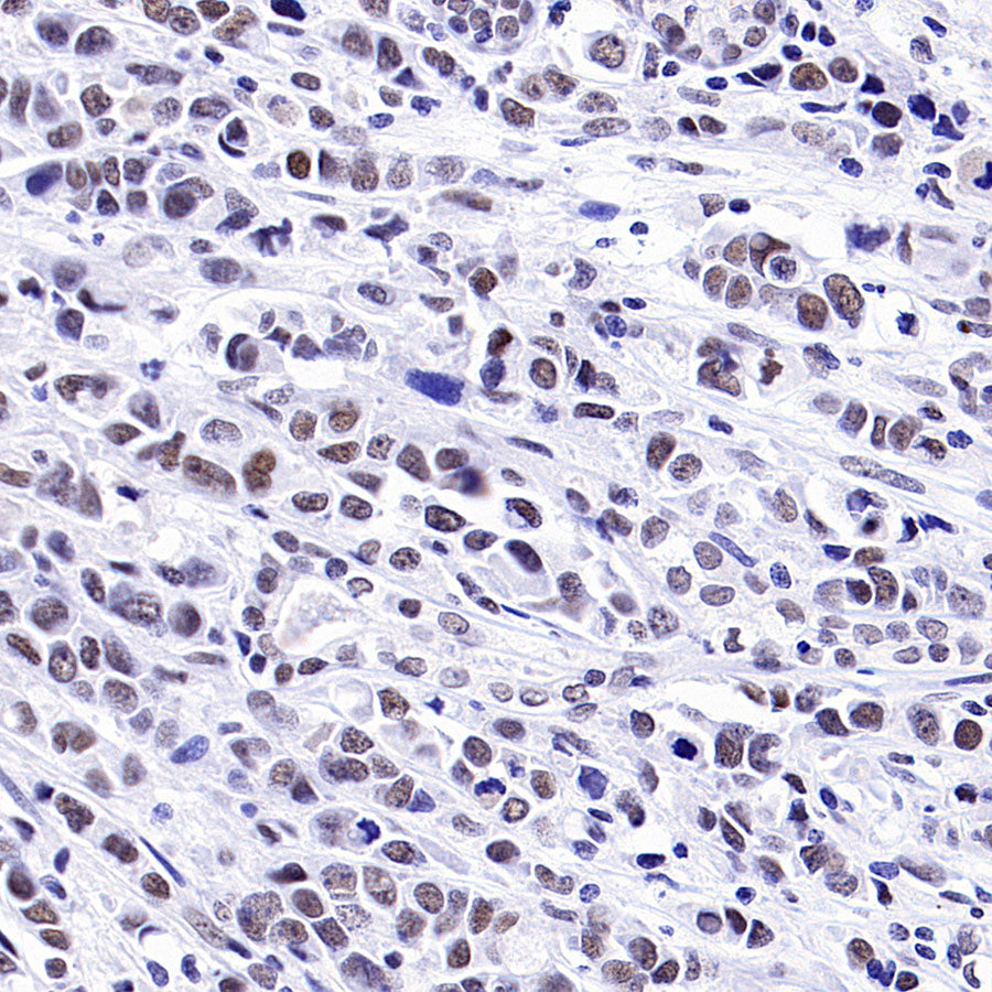 INI-1/SMARCB1 Recombinant Rabbit mAb (S-4068-21)
