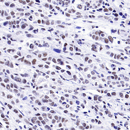 INI-1/SMARCB1 Recombinant Rabbit mAb (S-4068-21)