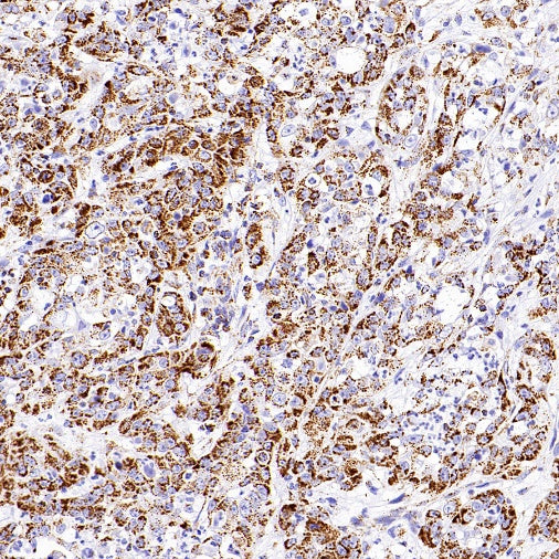 SHMT2/SHMT Recombinant Rabbit mAb (S-1581-5)
