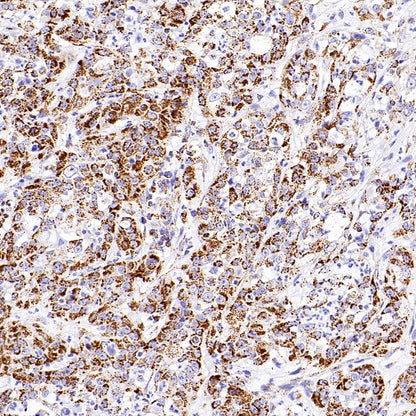 SHMT2/SHMT Recombinant Rabbit mAb (S-1581-5)