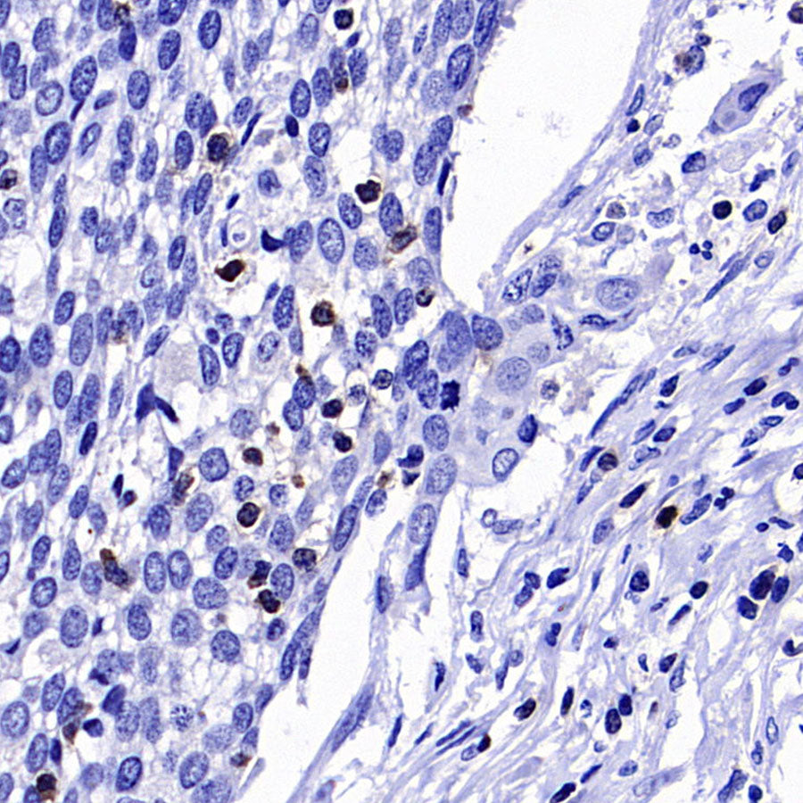 CD96 Recombinant Rabbit mAb (S-5322)