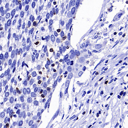 CD96 Recombinant Rabbit mAb (S-5322)