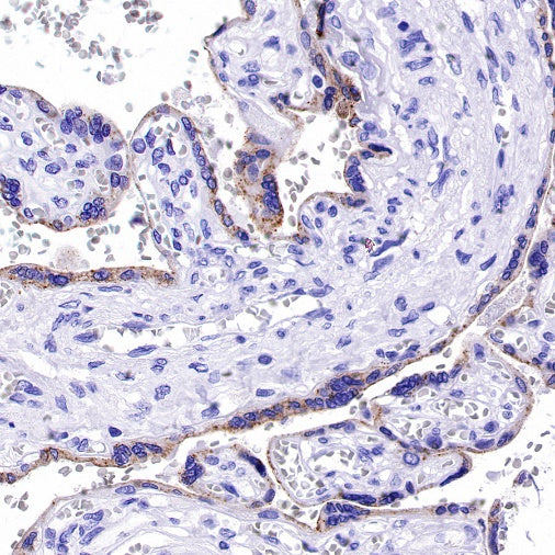 GDF-15 Recombinant Rabbit mAb (S-1012-42)