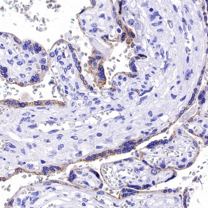 GDF-15 Recombinant Rabbit mAb (S-1012-42)