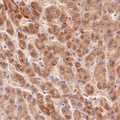 AMACR/p504s Recombinant Rabbit mAb (SDT-401-29)