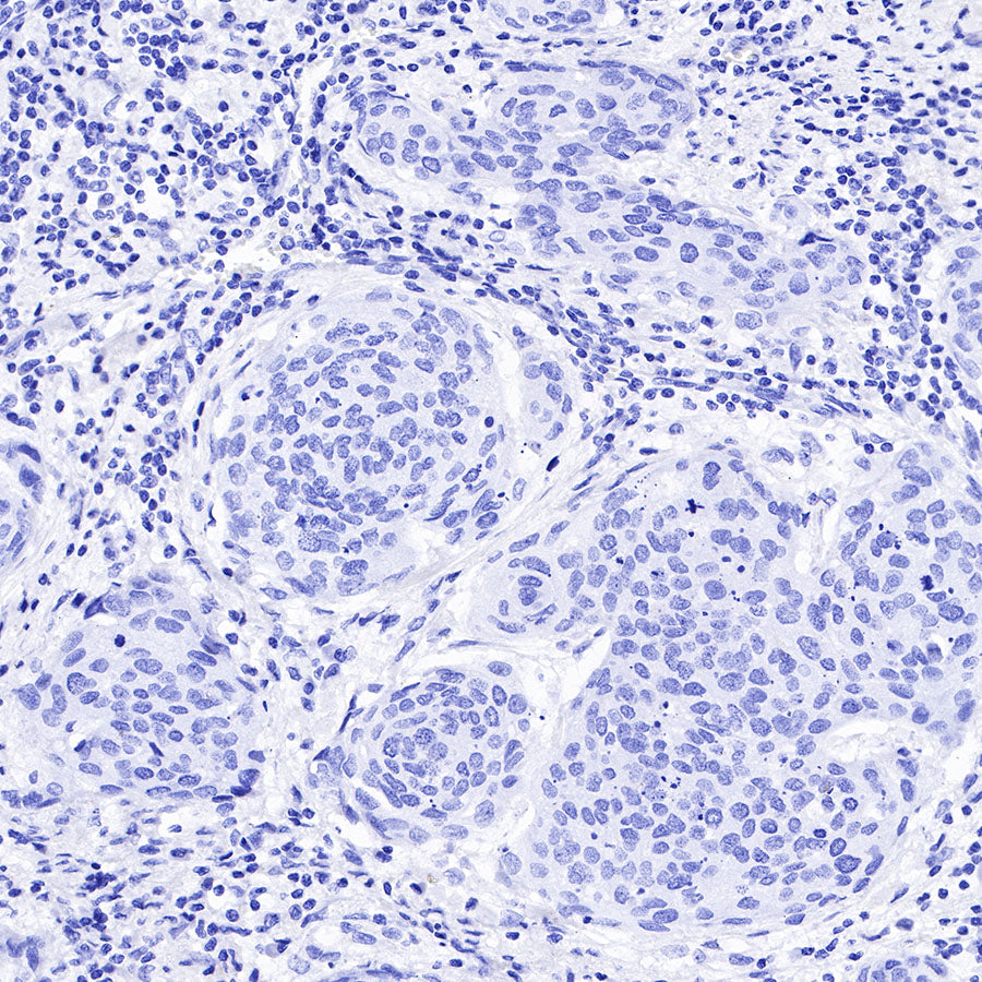 Androgen Receptor Recombinant Rabbit mAb (SDT-R157)
