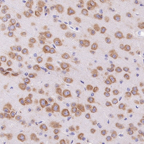 YTHDF1 Recombinant Rabbit mAb (S-3433-13)
