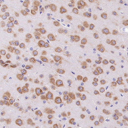 YTHDF1 Recombinant Rabbit mAb (S-3433-13)