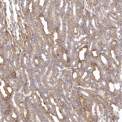 Calpain 1 Recombinant Rabbit mAb (S-3797-41)