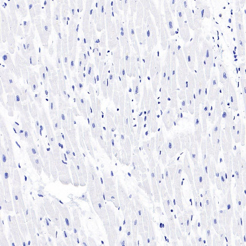 CYP11A1 Rabbit Polyclonal Antibody