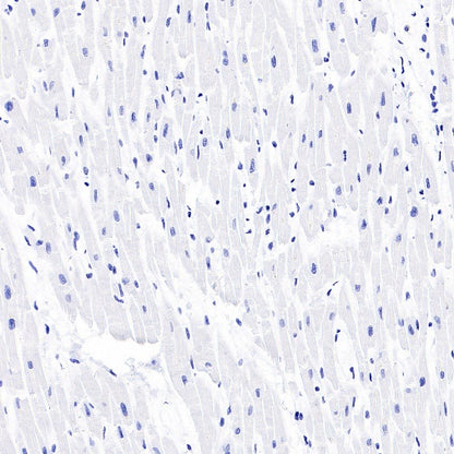CYP11A1 Rabbit Polyclonal Antibody
