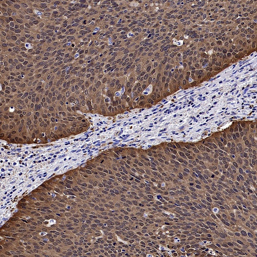 GCLM Recombinant Rabbit mAb (S-2209-19)