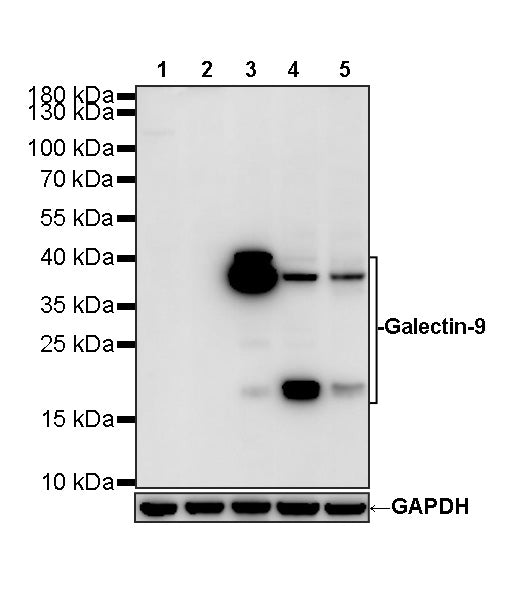Galectin-9 Recombinant Rabbit mAb (S-4579-67)