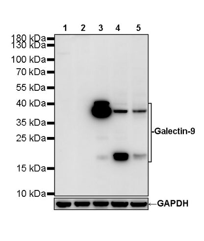 Galectin-9 Recombinant Rabbit mAb (S-4579-67)