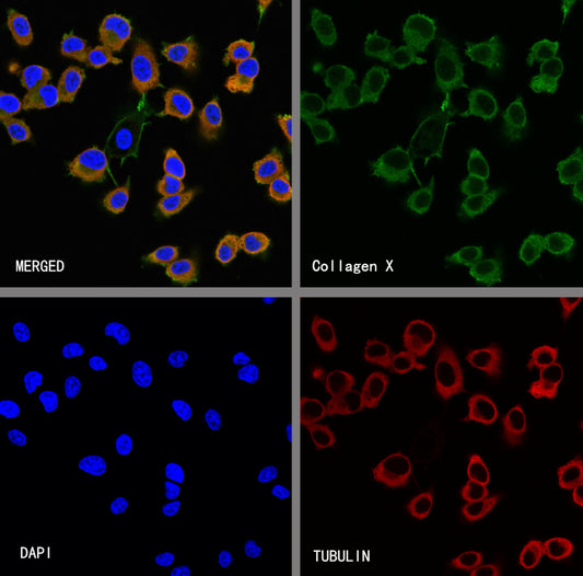 Collagen X Recombinant Mouse mAb (S-M0004)