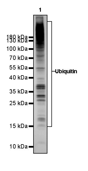 Ubiquitin Rabbit mAb (SDT-R095)