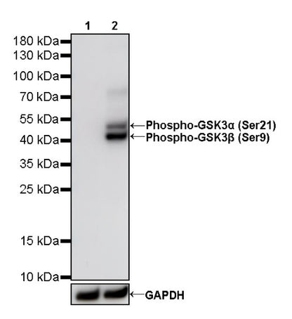 Phospho-GSK3α/β (Ser21/9) Recombinant Rabbit mAb (S-1529-102)