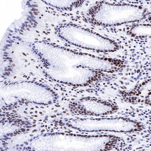 Propionyl-Histone H4 (Lys5) Recombinant Rabbit mAb (S-R093)