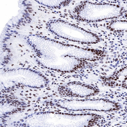 Propionyl-Histone H4 (Lys5) Recombinant Rabbit mAb (S-R093)